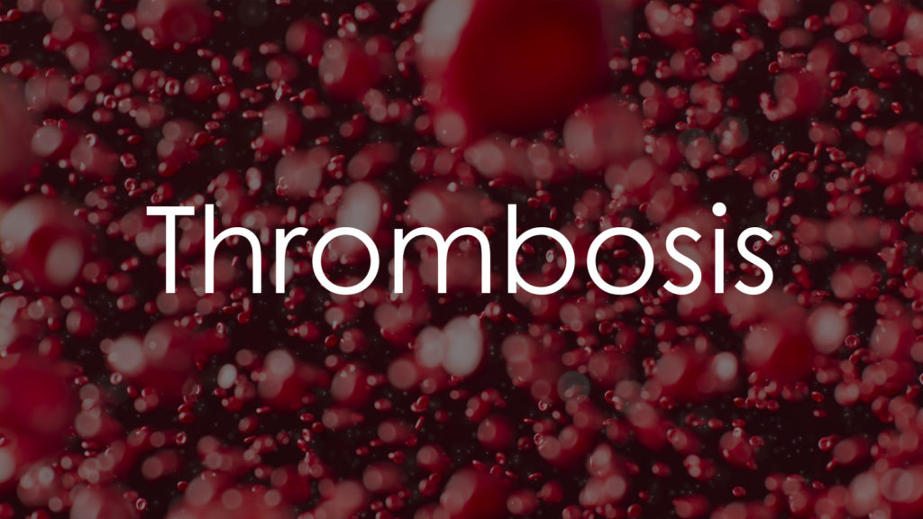 Thrombosis