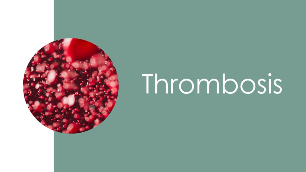 Thrombosis 2