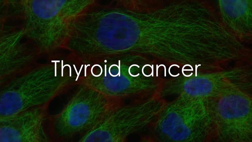 Thyroid cancer