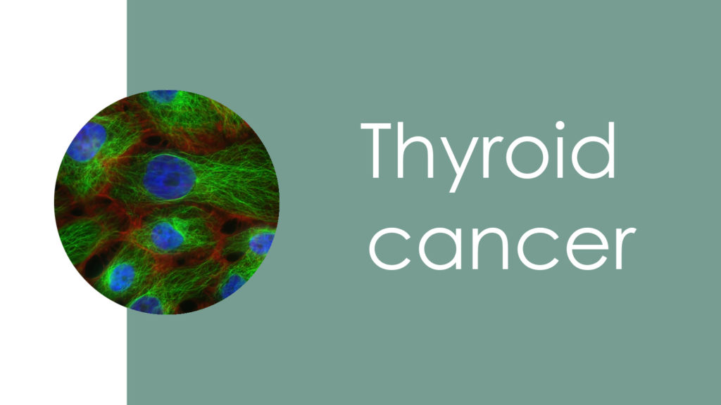 Thyroid cancer3