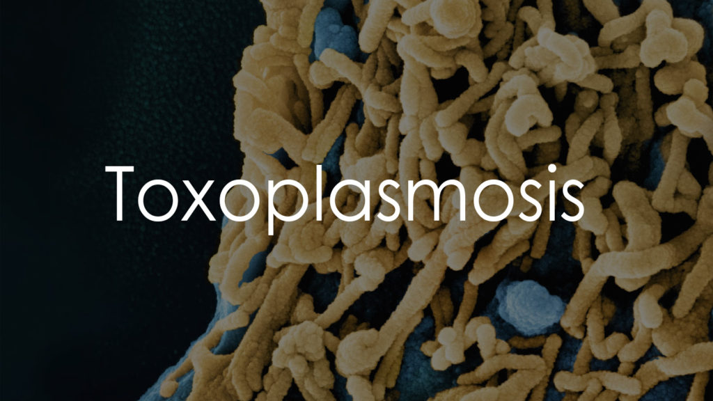 Toxoplasmosis