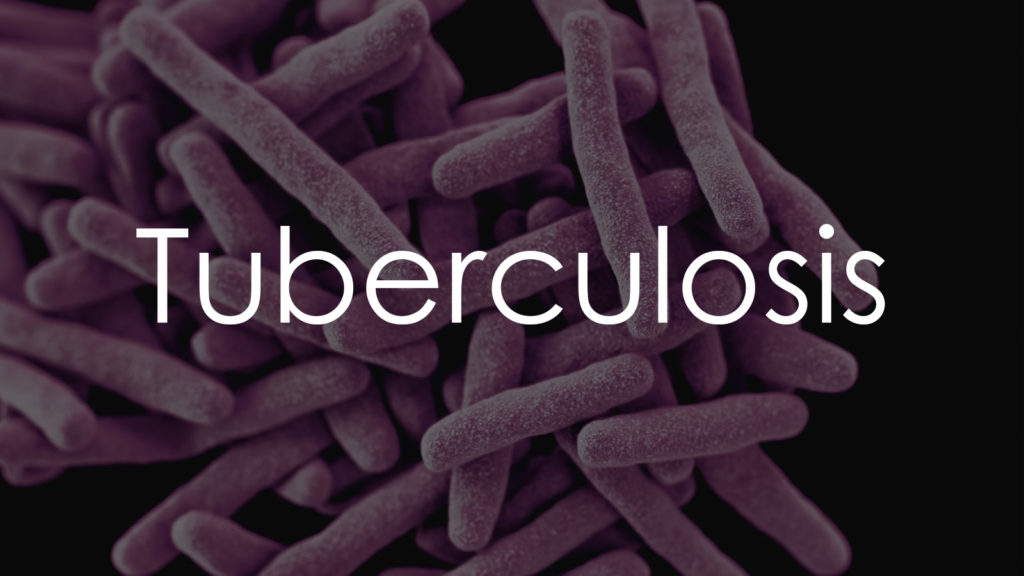 Tuberculosis