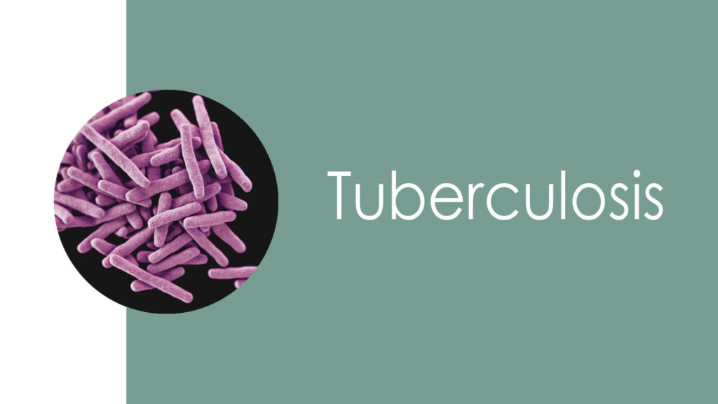 Tuberculosis2