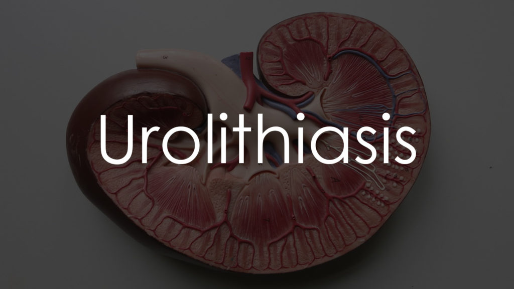 Urolithiasis