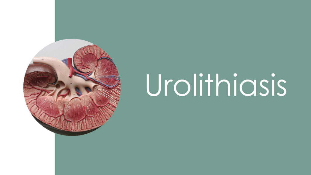 Urolithiasis 2