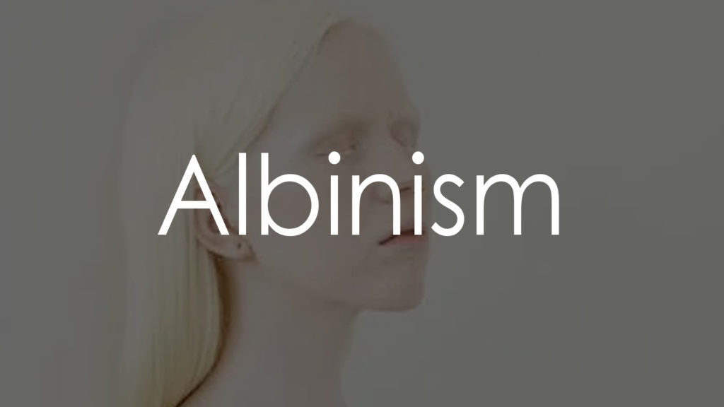 Albinism