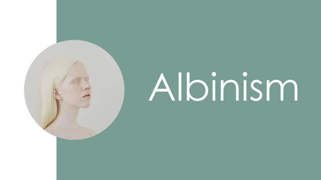 Albinism2