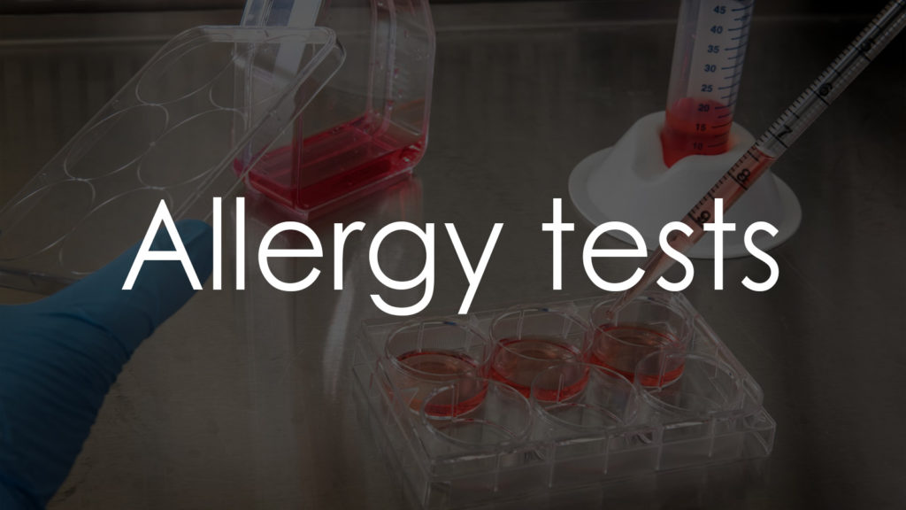 Allergy tests