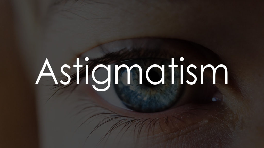 Astigmatism