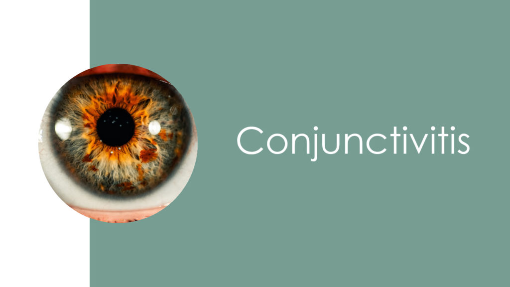 Conjunctivitis2