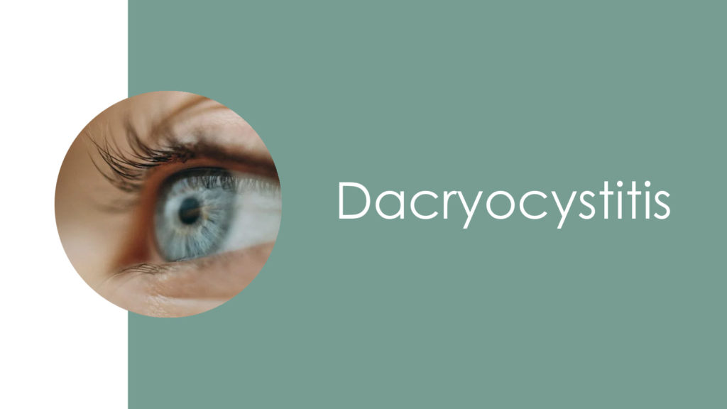 Dacryocystitis2