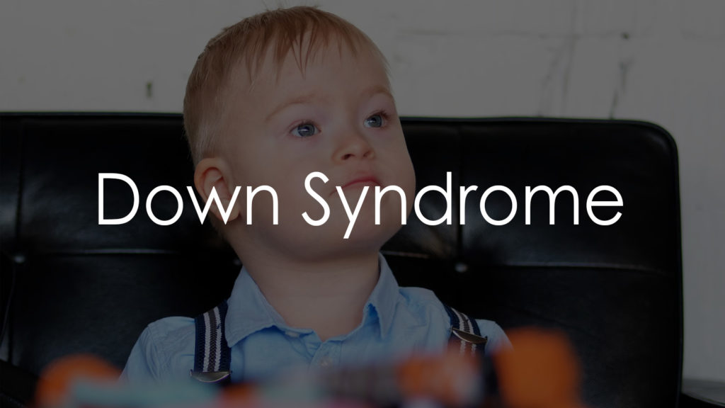 Down Syndrome4