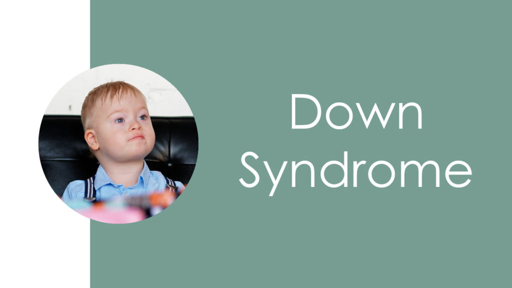 Down Syndrome5