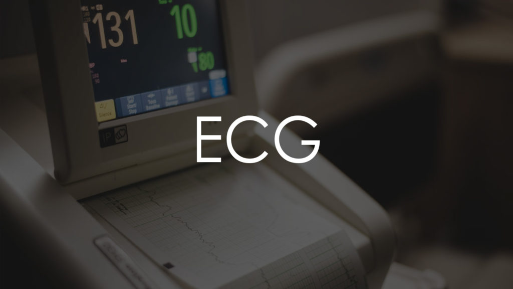 ECG