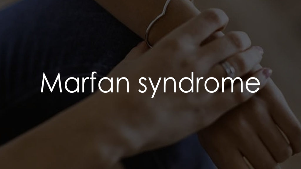 Marfan syndrome