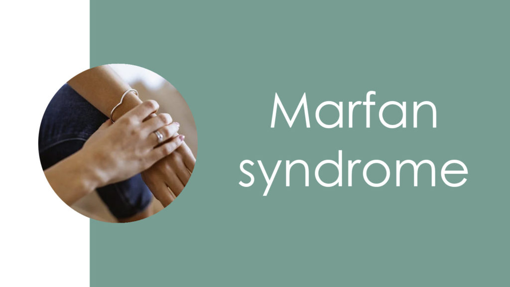 Marfan syndrome2