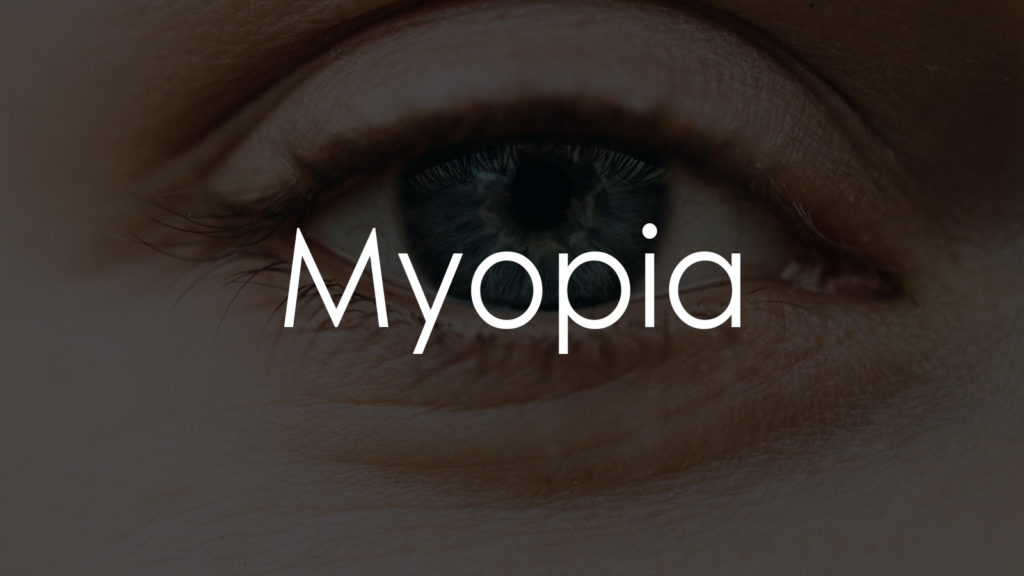 Myopia