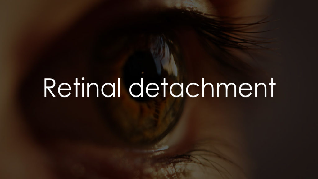 Retinal detachment