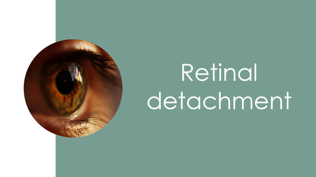 Retinal detachment2