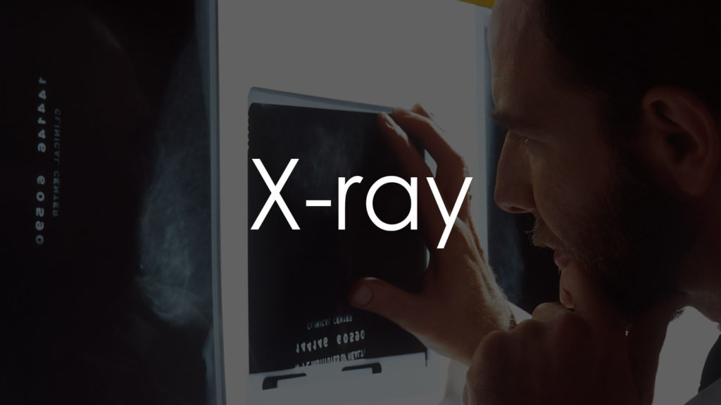 X-ray