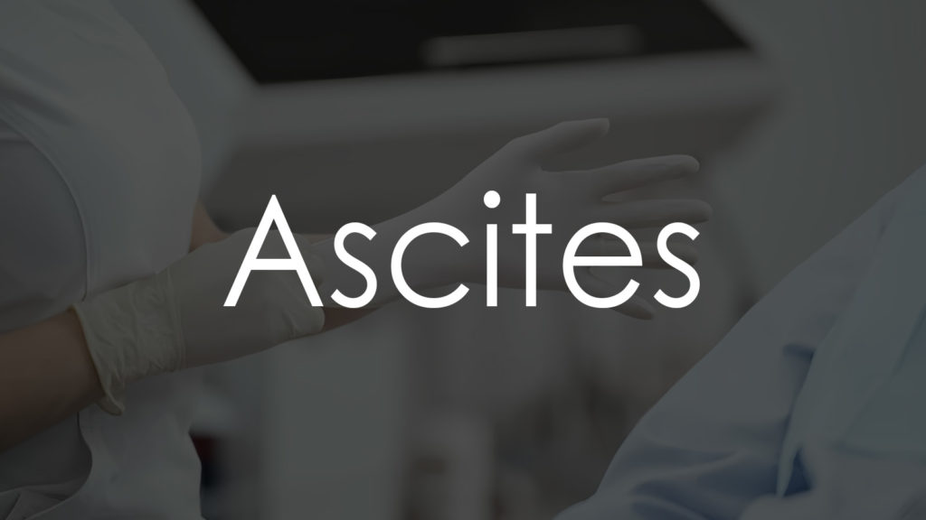 Ascites