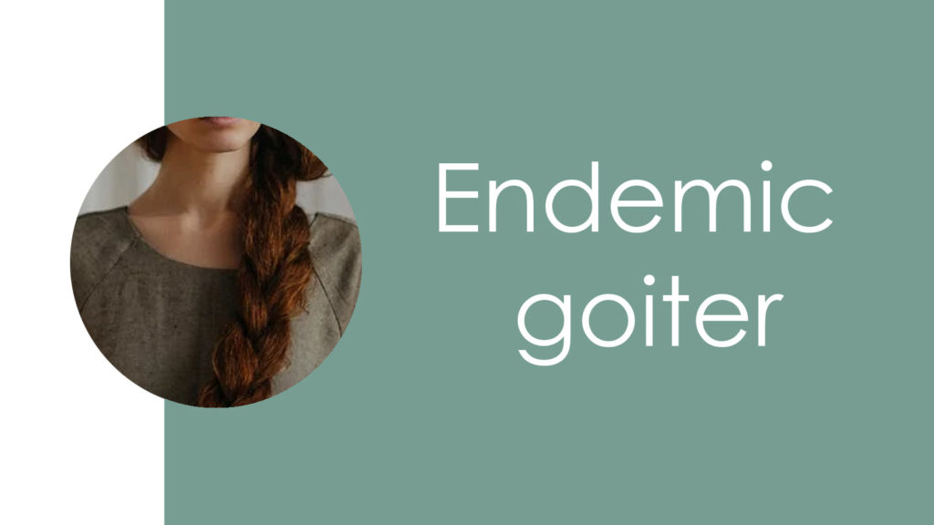 Endemic goiter2