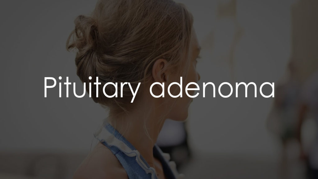 Pituitary adenoma