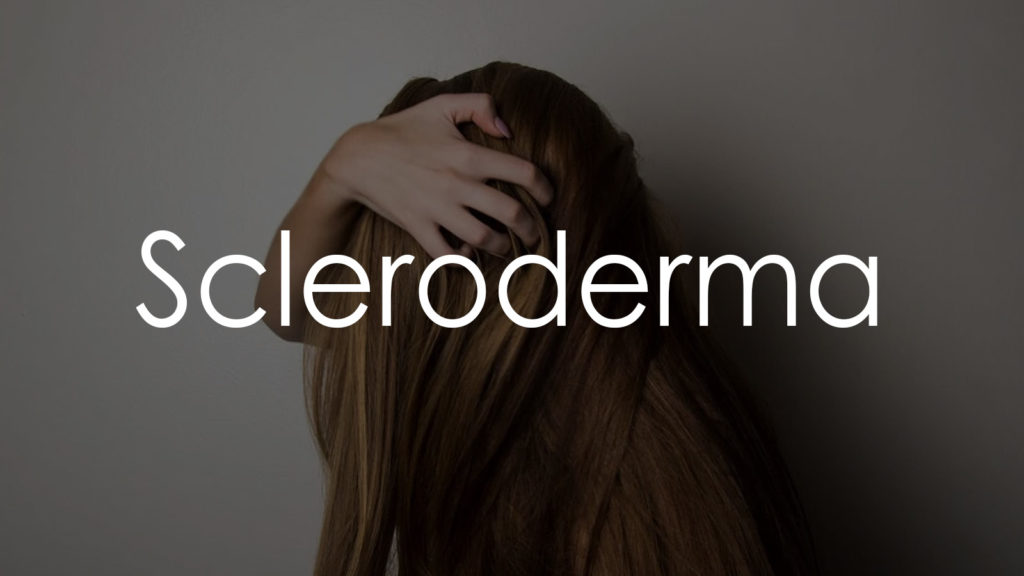 Scleroderma