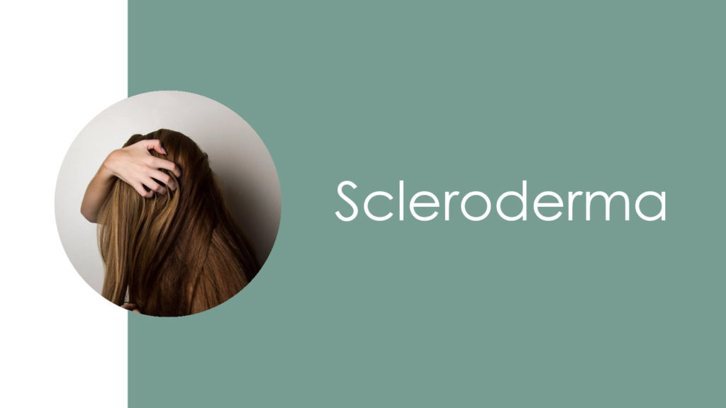 Scleroderma2