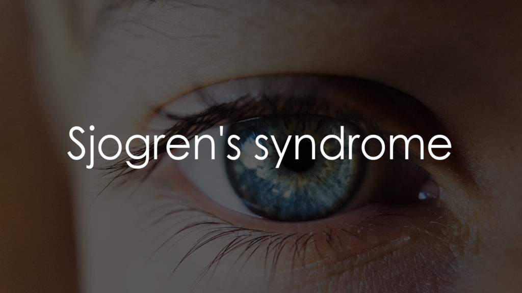 Sjogrens-syndrome