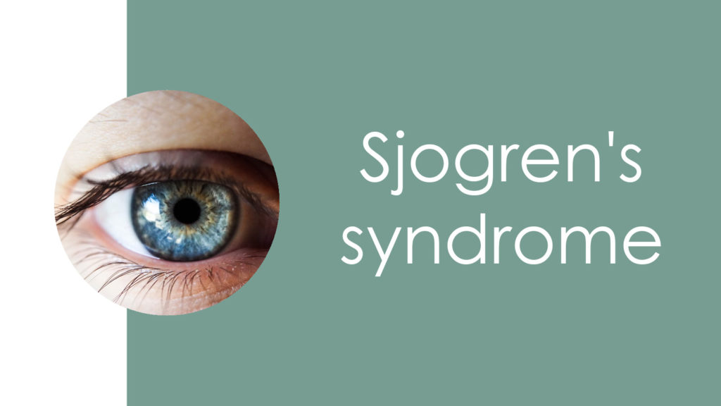 Sjogren's syndrome2