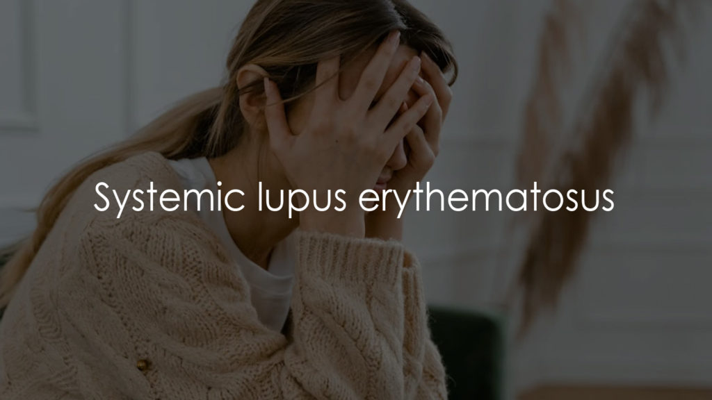 Systemic lupus erythematosus