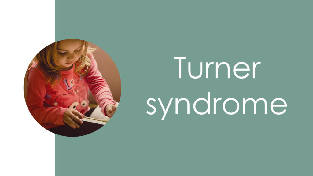 Turner syndrome3